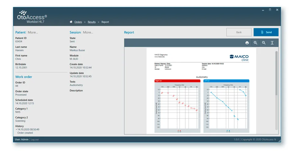 OtoAccess Worklist HL7 Screenshot